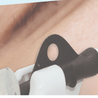 Skinbooster/Infuzion