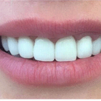Hem