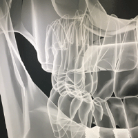 Implantat